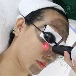 ảnh chụp màn hình cách trị nám da bằng trứng gà