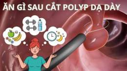 ảnh chụp màn hình cắt polyp dạ dày có ăn được thịt gà không