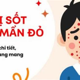 bé sốt nổi da gà