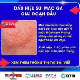 benh da ga