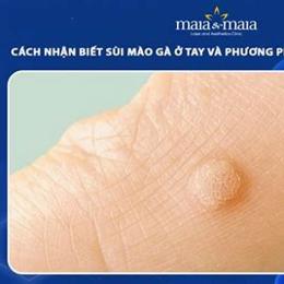 cách trị da gà ở cổ
