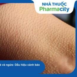 cách trị da sần như da gà ở cổ