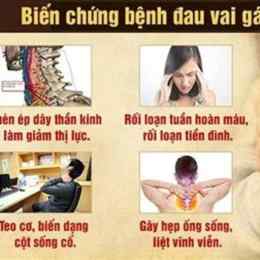 căng cơ cổ gây đau đầu