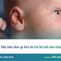 da bé bị nổi sần như da gà