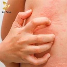da bị ngứa gãi nổi hột như da gà