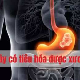 dạ dày có tiêu hóa được xương gà không