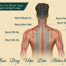 đau cổ vai gáy dân văn phòng