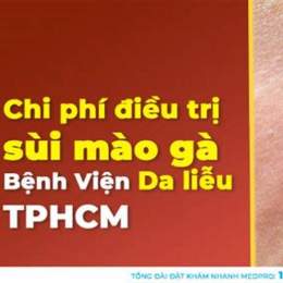 điều trị sùi mào gà ở bệnh viện da liễu