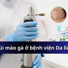 đốt sùi mào gà ở bệnh viện da liễu