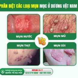 dương vật nổi da gà