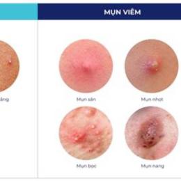 gà bị nổi mụn trên da
