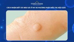 giao diện app bị da gà ở tay