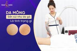 giao diện app cách trị da sần như da gà