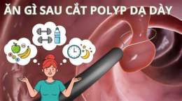 giao diện app cắt polyp dạ dày có ăn được thịt gà không