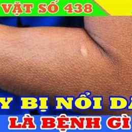 hay bị nổi da gà ớn lạnh