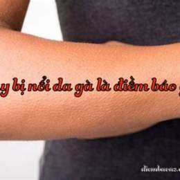 hay bị nổi da gà