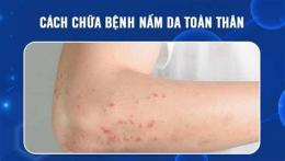 hướng dẫn sử dụng cách chữa bệnh nấm da ở gà trống