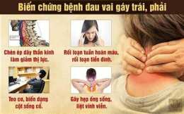 hướng dẫn sử dụng căng cơ cổ vai gáy gây đau đầu