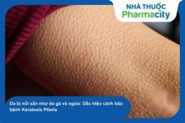 hướng dẫn sử dụng da bị nổi sần như da gà nhưng không ngứa