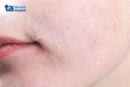 hướng dẫn sử dụng da có bị sần như da gà