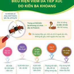 kiến ba khoang gây bỏng da
