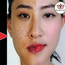 làm trắng da bằng lòng đỏ trứng gà