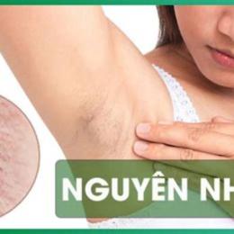 nách bị sần da gà