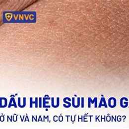 sùi mào gà có lây qua da không