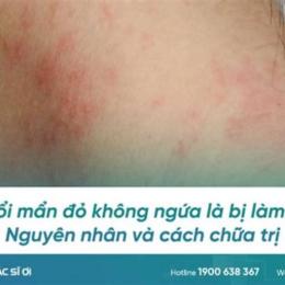 tại sao lại bị nổi da gà