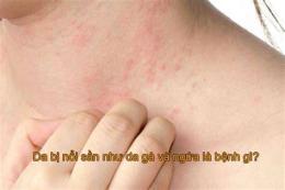 tính năng nổi bật bị da gà
