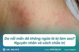 tính năng nổi bật cổ bị da gà phải làm sao