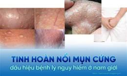 tính năng nổi bật cổ nổi mụn như da gà