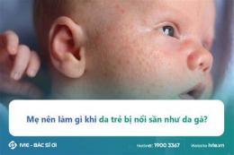 tính năng nổi bật da bé nổi sần như da gà