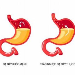trào ngược dạ dày có ăn được trứng gà không
