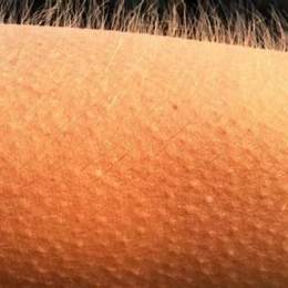 tự nhiên nổi da gà là điềm gì