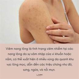 viêm nang lông nách nách sần sùi như da gà